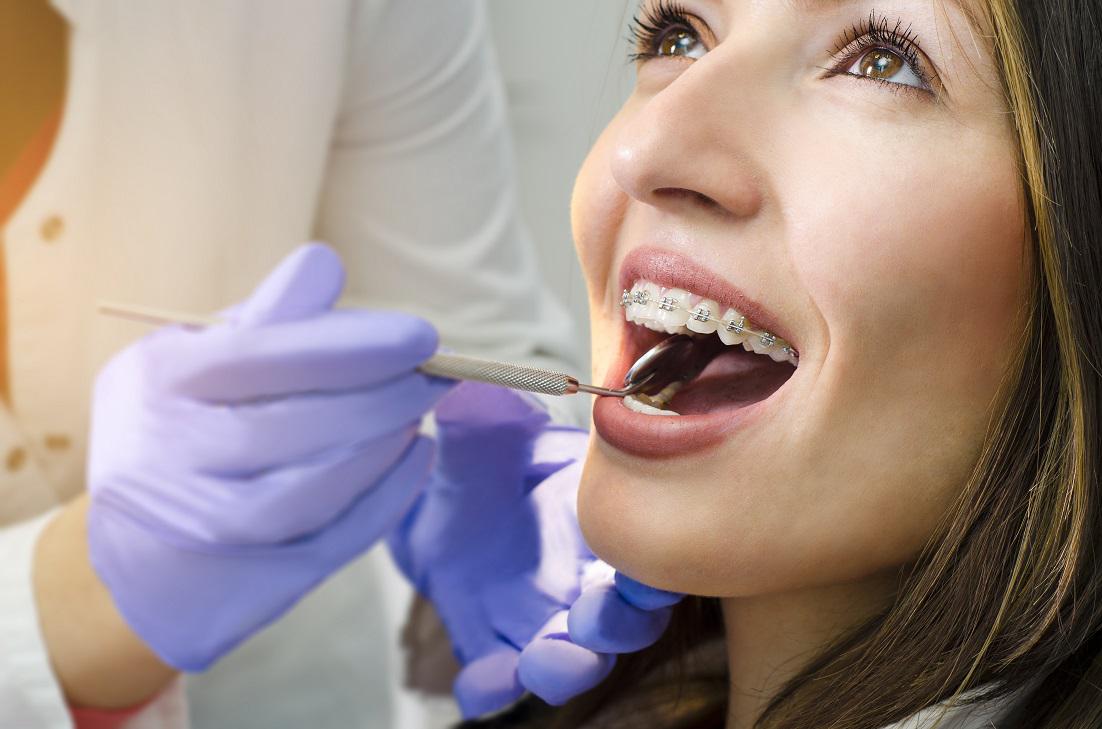 Do Braces Hurt?  Tips on How to Alleviate Mild Braces Discomfort