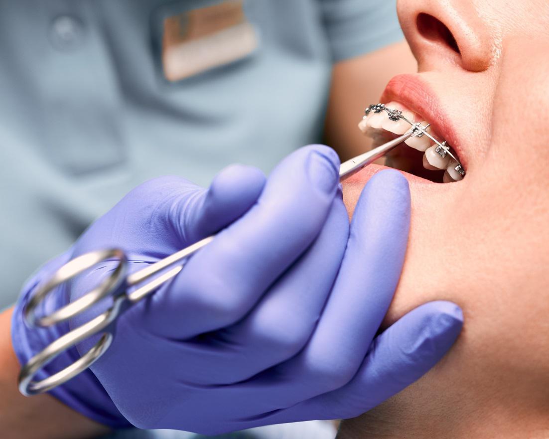 How Does Orthodontics Work To Shift Teeth?