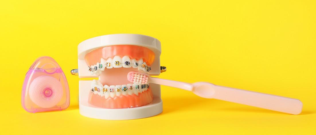Ensure Healthy Teeth & Gums During Your Orthodontic Treatment