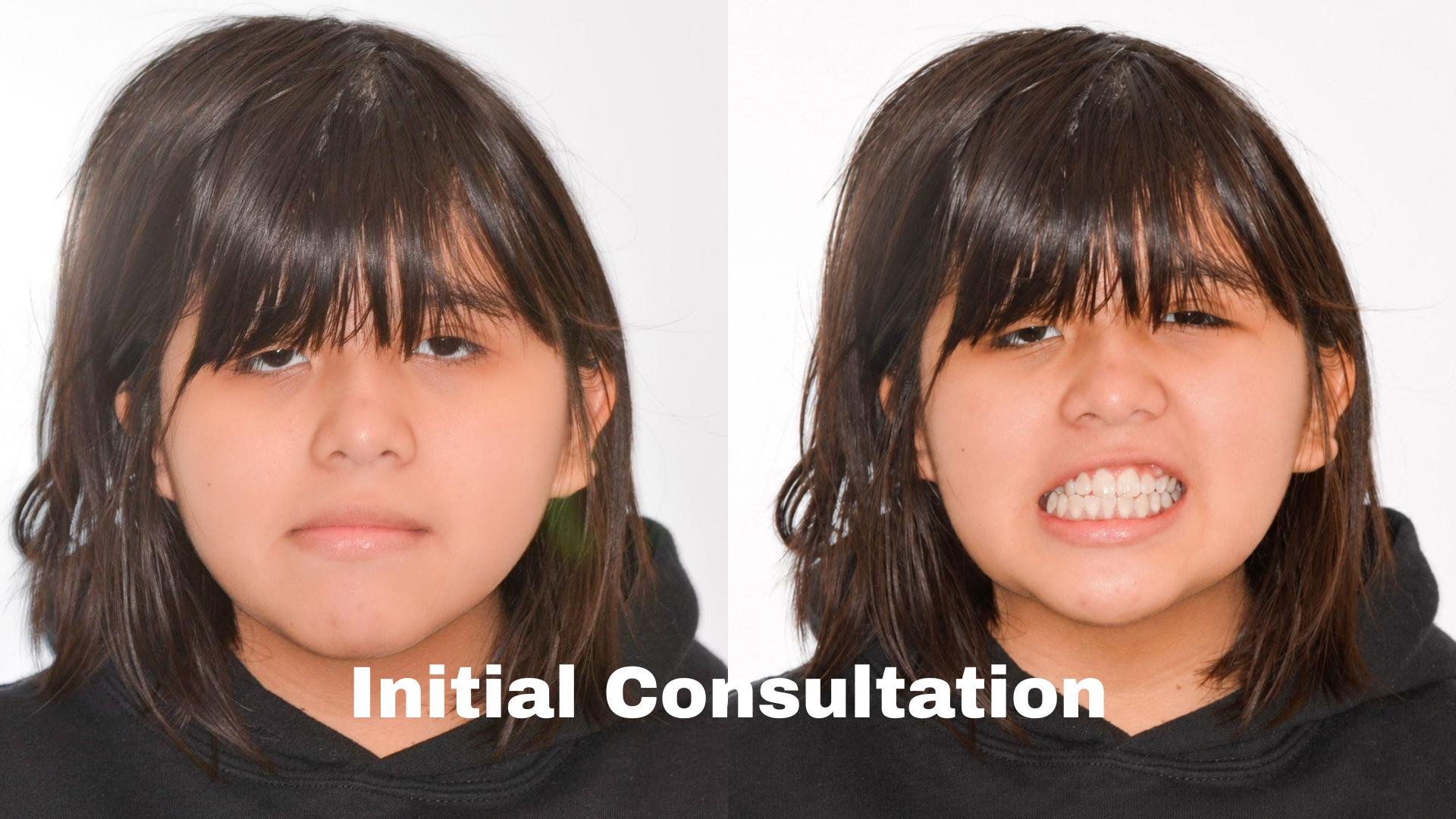 initial consultation for advanced facial orthodontics in Northern Virginia