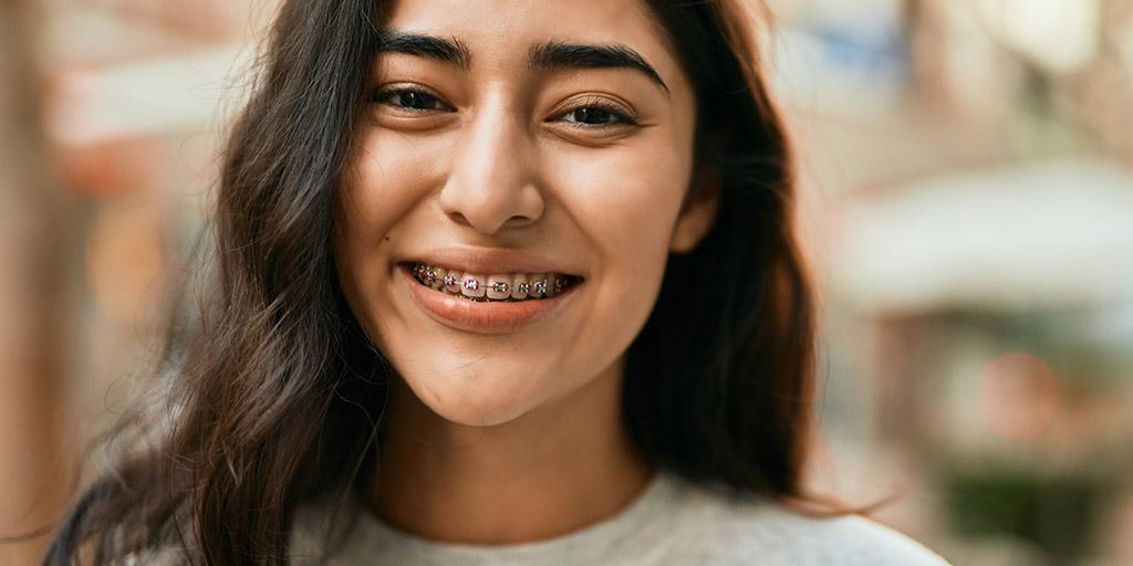 When is the Right Time to Get Braces for Your Child?