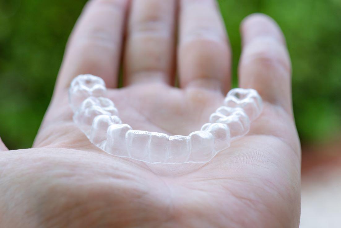 What Happens if You Skip Wearing Aligners?